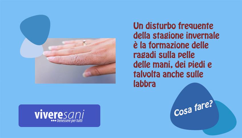 Ragadi su mani e piedi Ragadi su mani e piedi